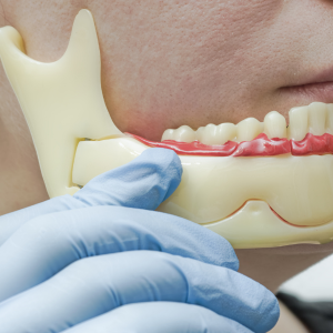 TOOTH EXPOSURE WITH BONE CUTTING